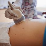 ultrasound abdomen infertility pcos