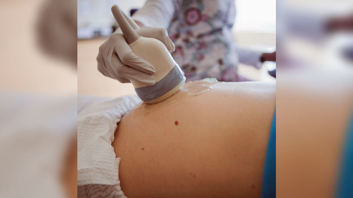 ultrasound abdomen infertility pcos