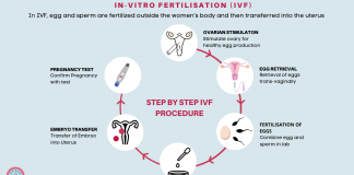 In_Vitro_Fertilization_(IVF) Embryo Transfer