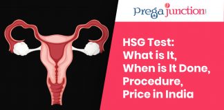 HSG Test For Female Infertility