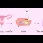 Embryo Transfer In IVF