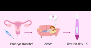 Embryo Transfer In IVF