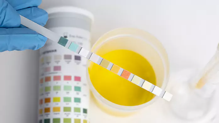 Change in Urine color during Pregnancy