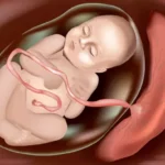 What needs to be done if there are differences in the Umbilical Cord and Placenta