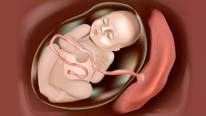 What needs to be done if there are differences in the Umbilical Cord and Placenta