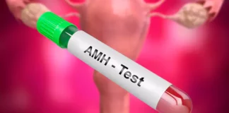 Anti-Mullerian Hormone (AMH) Tests and Effect on Fertility