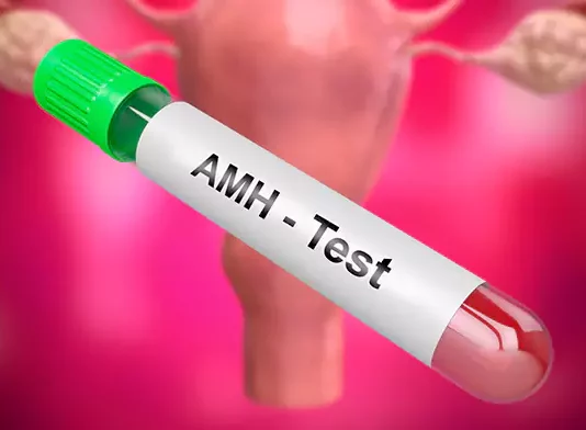 Anti-Mullerian Hormone (AMH) Tests and Effect on Fertility