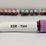 ESR Test During Pregnancy